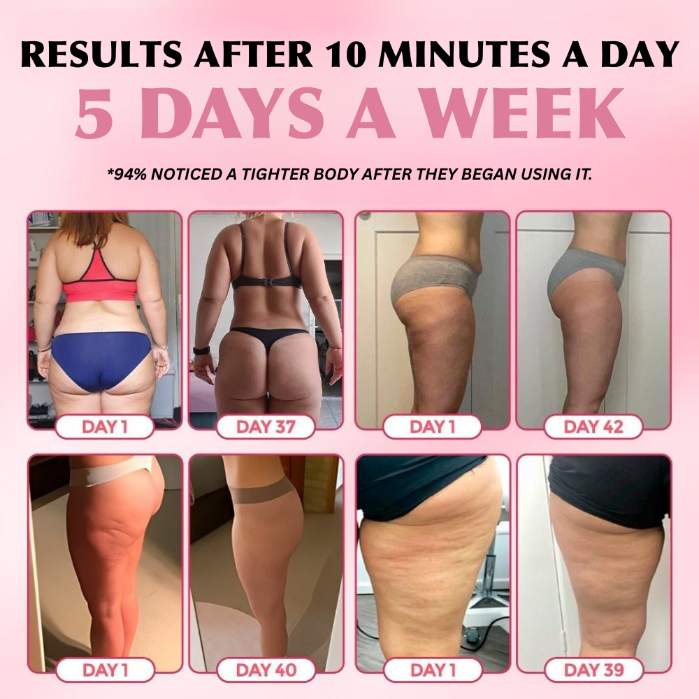 NOVA™ Body